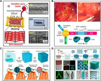 Natural polymer-based scaffolds for soft tissue repair